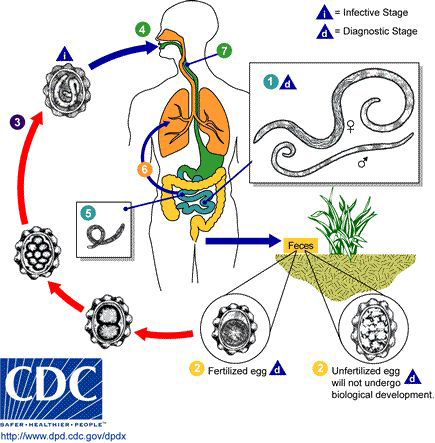 Ascariasis lumbricoides in the human body: Image courtesy of the CDC